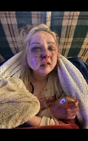 494261800_122132337386793884_8235532257323160546_n Nikki Creel Fitch: North Platte Woman Battles for Survival After Brutal Attack, Community Unites in Support